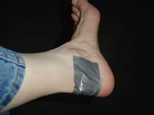 duct tape foot